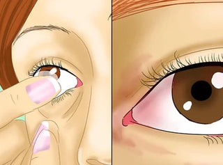 How To Tell When Contacts Need To Be Replaced